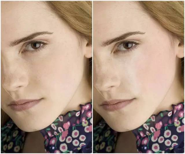 美女与野兽｜天生法令纹只能靠整容吗？那是因为你没看这篇！