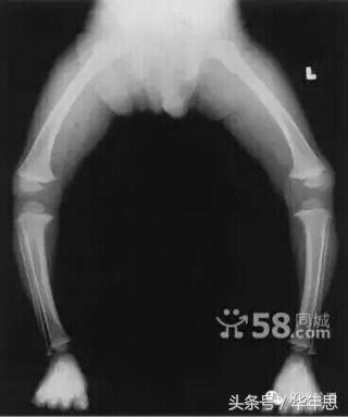 如何选购适合自己的轮滑鞋,2023年成人轮滑鞋品牌选购清单