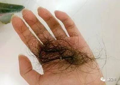 痰湿为什么会导致脱发,雄性激素脱发是什么原因导致的