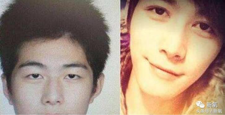 为什么开眼角会变漂亮,为什么开眼角很奇怪