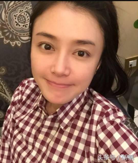 为什么开眼角会变漂亮,为什么开眼角很奇怪