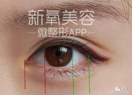 为什么开眼角会变漂亮,为什么开眼角很奇怪