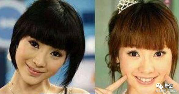 为什么开眼角会变漂亮,为什么开眼角很奇怪