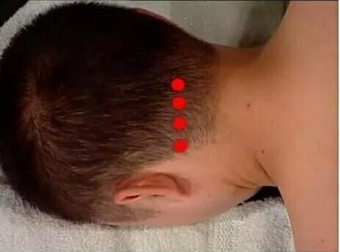 脑中风最佳抢救时间是多久,如何急救脑中风发作