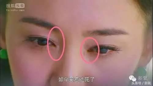 为什么开眼角会变漂亮,为什么开眼角很奇怪