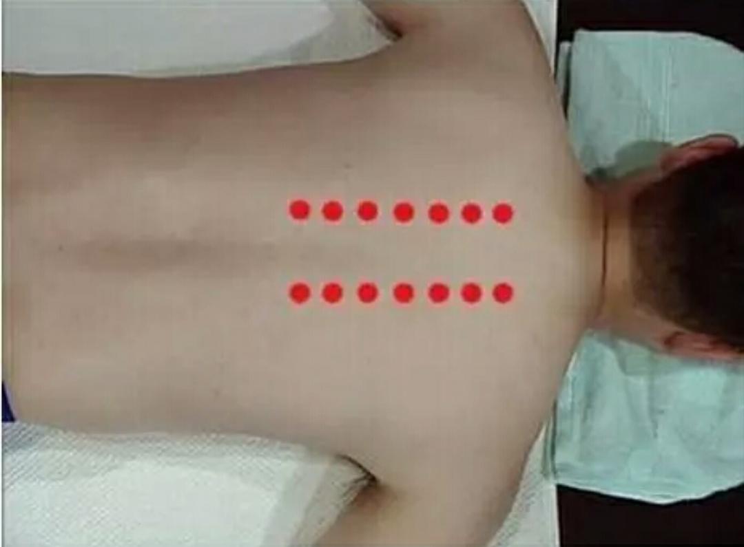 脑中风最佳抢救时间是多久,如何急救脑中风发作