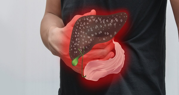 这种疾病最容易诱发肝癌，五种方法可以预防还不花一分钱