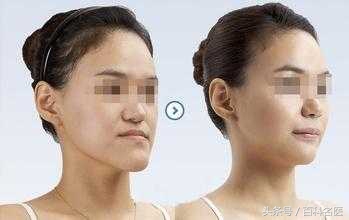 牙齿畸形的六个表现,牙齿畸形矫正图片大全