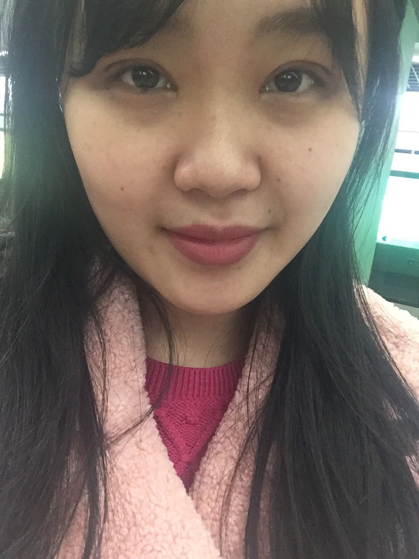 全切双眼皮感觉很窄后期会变宽嘛,内双的人割双眼皮会更自然吗