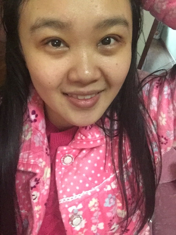 全切双眼皮感觉很窄后期会变宽嘛,内双的人割双眼皮会更自然吗