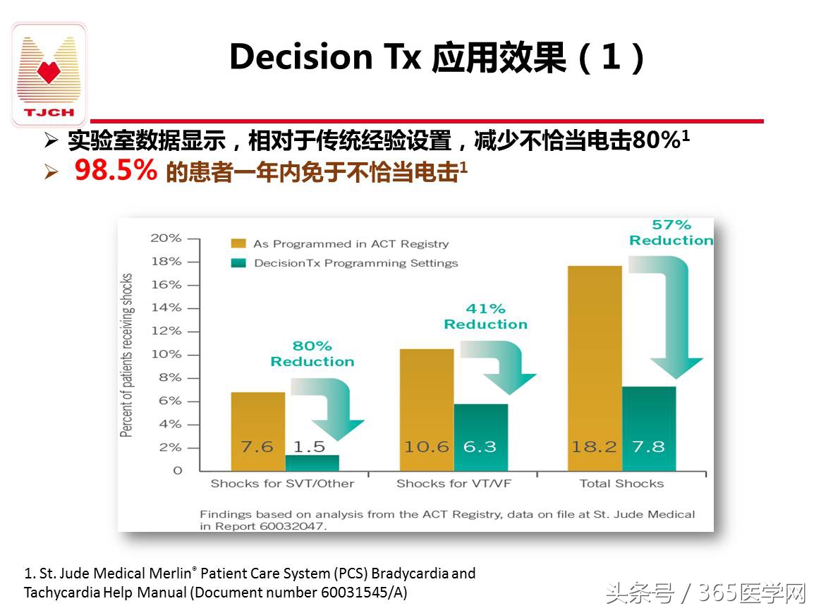 许静：新技术避免ICD不恰当放电
