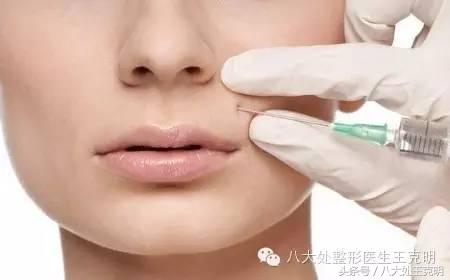 打肉毒素瘦脸苹果肌会塌陷吗,衡力肉毒素既可以瘦脸也可以除皱