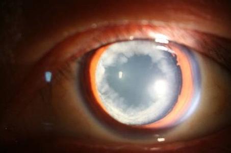 可以让中医下岗的八种疾病