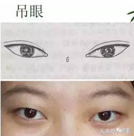 为什么开眼角会变漂亮,为什么开眼角很奇怪