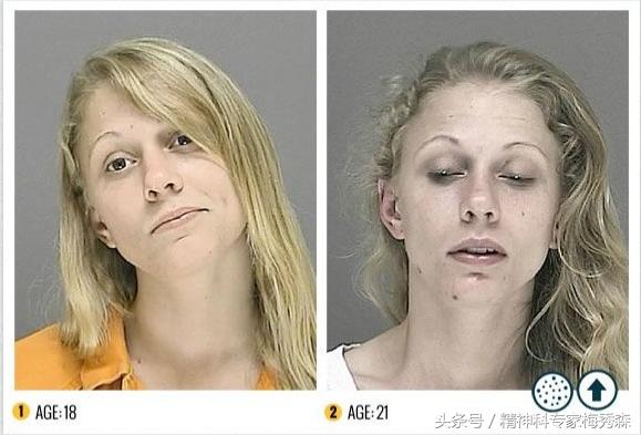 吸毒中危害最大的是什么,吸毒对人体的危害性有多大