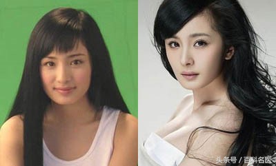 牙齿畸形的六个表现,牙齿畸形矫正图片大全