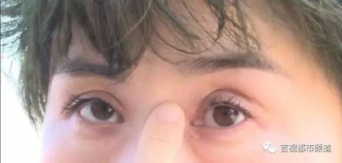 伶秀天成美容院,伶秀天成医疗美容好吗