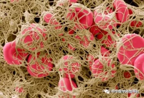 长血栓吃什么药最好,长血栓