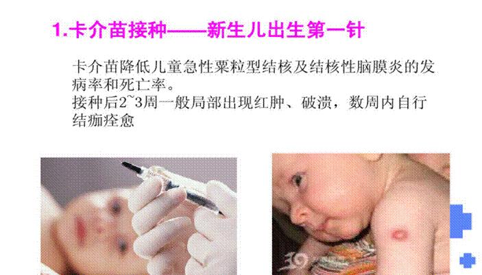 肺结核治疗与预防基础知识,如何正确的治疗肺结核科普