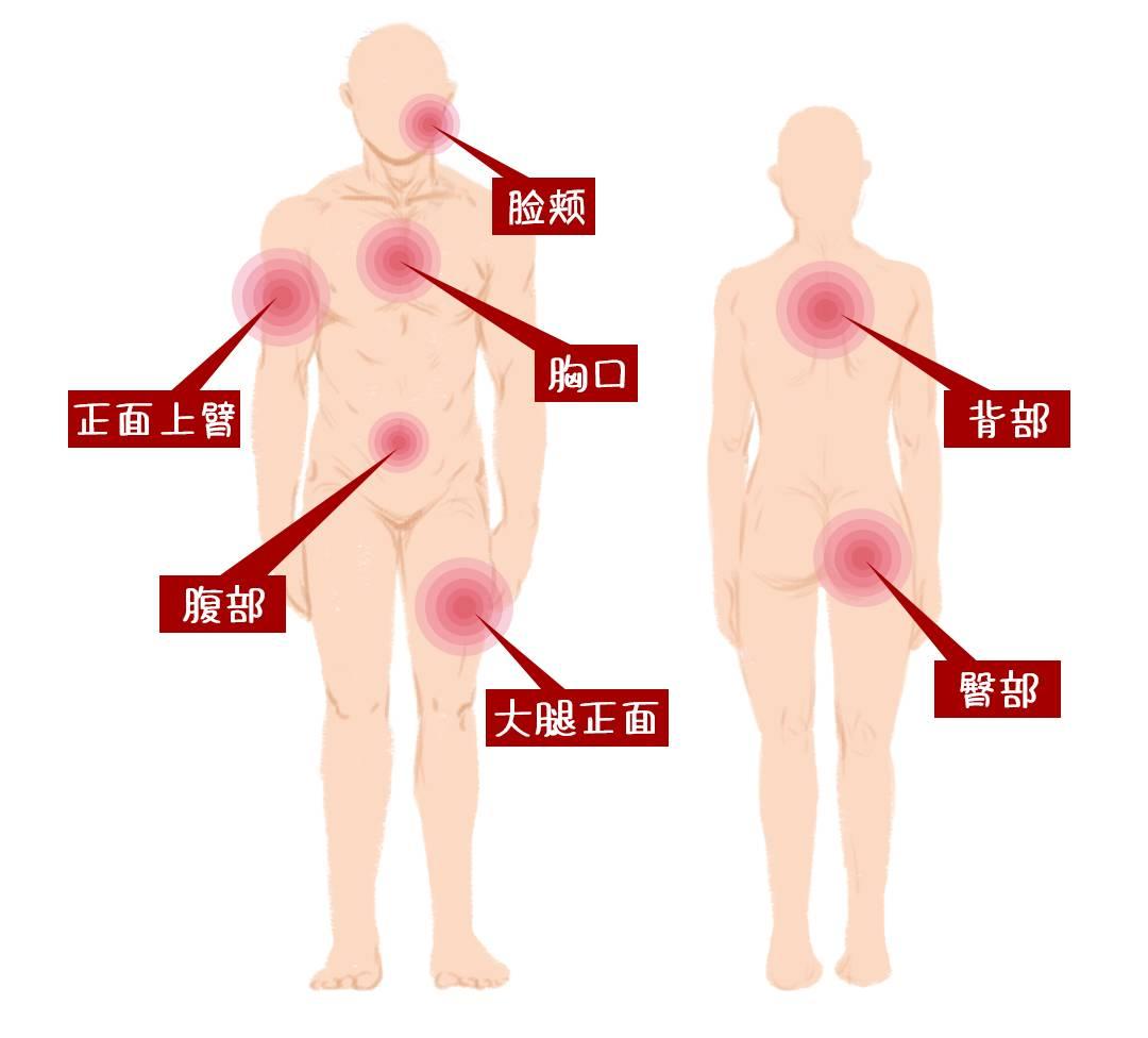 皮肤起红疹老不好用什么药,皮肤上有红点怎么调理