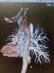 下肢肿胀有效的治疗手段是什么？