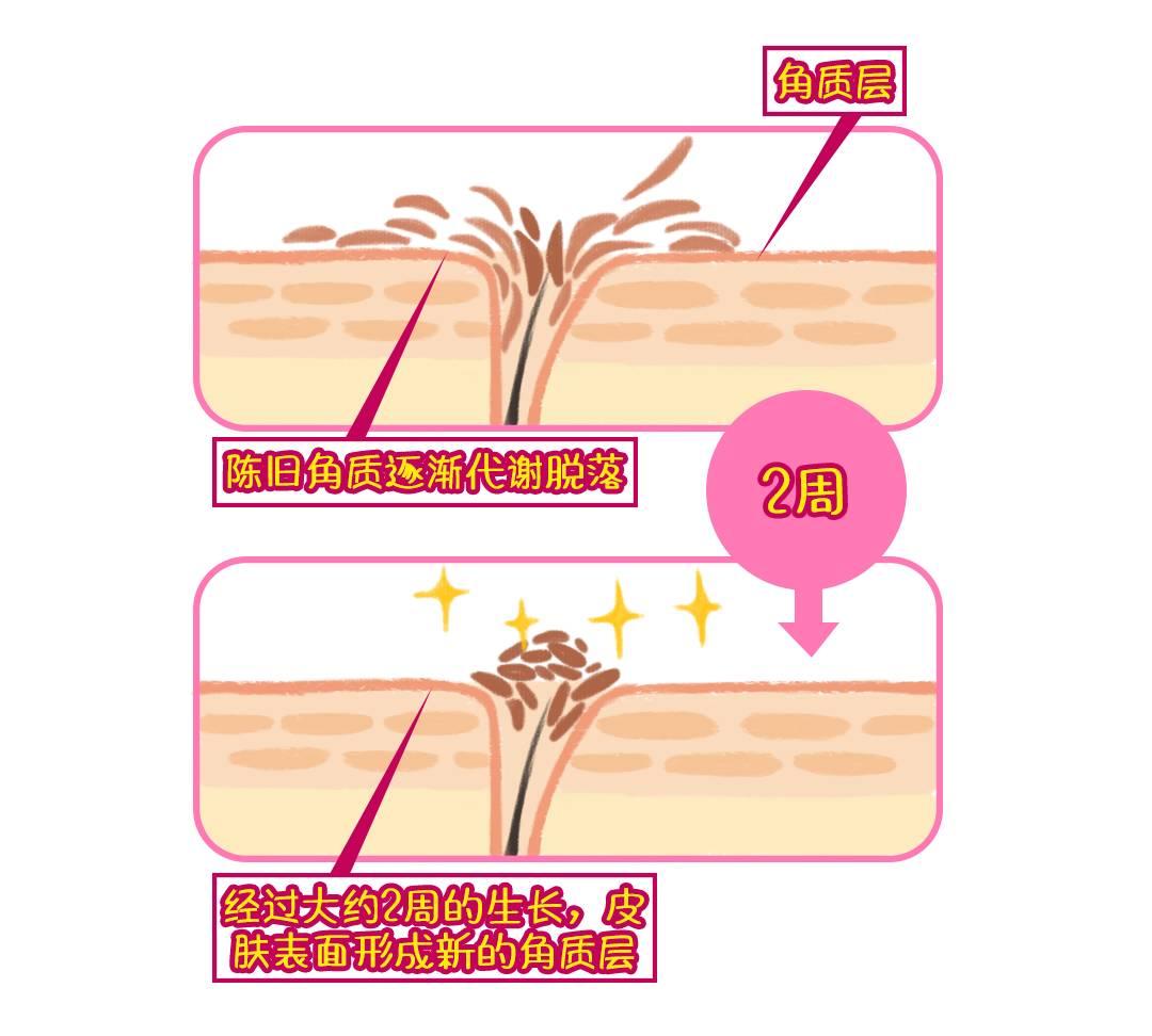 皮肤起红疹老不好用什么药,皮肤上有红点怎么调理