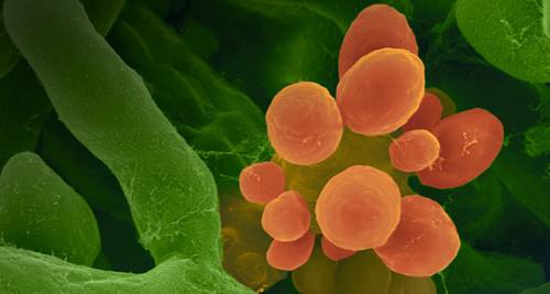 过敏体质者应该怎么来改善