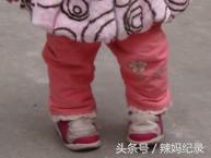 宝宝o型腿矫正方法,宝宝o型腿矫正全过程