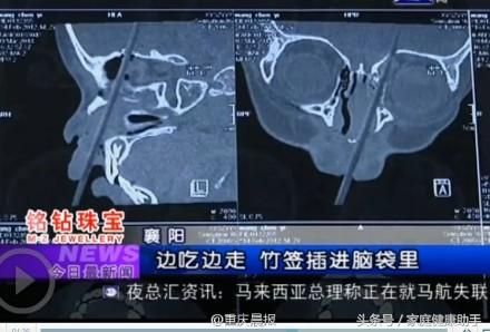 那些看完让人心酸的事,这些日常的隐患容易被忽略