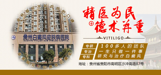 女性患白癜风和内分泌有关系吗,女性白癜风患者该如何正确治疗