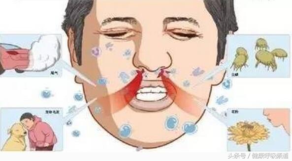 肺气肿患者总是咳嗽，该怎么办？