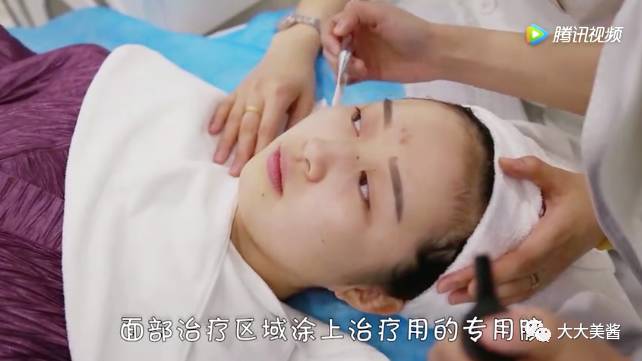 视频|还没到30,皮肤松弛了?不开刀也不疼的射频提升?