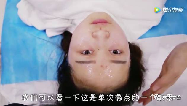 视频|还没到30,皮肤松弛了?不开刀也不疼的射频提升?