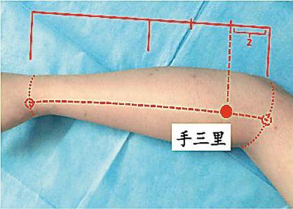 灸哥论穴：用艾灸疗法调理网球肘