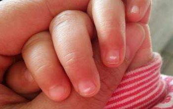 准妈妈实用技能:如何判断宝宝得了蛔虫病附治疗方式