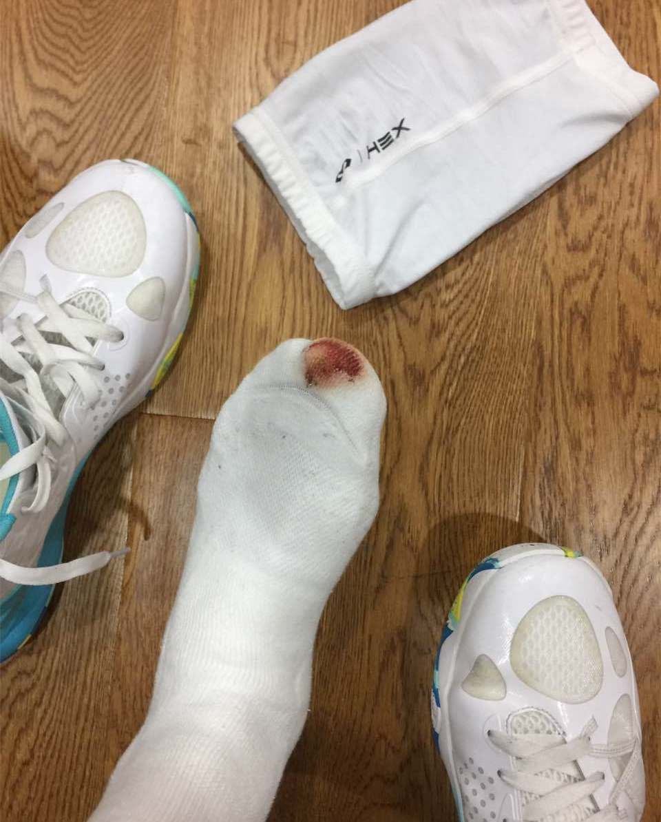 运动员的背后你知多少？训练练到双膝红肿淤青，甚至脚趾盖磨掉！