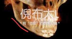 削骨整形的最佳方法,磨骨整形和削骨