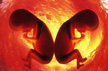 自然怀双胞胎的风险,试管怀双胞胎的风险