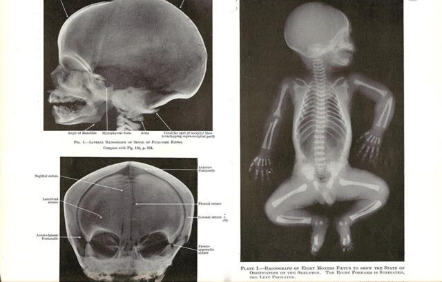 孕妇必知的胎儿每月发育日程,孕期1月到10月胎儿发育全过程
