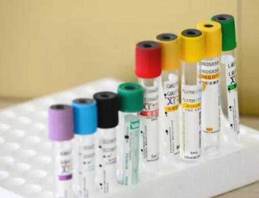 史上最全面的检查项目解读,为了你及家人的健康