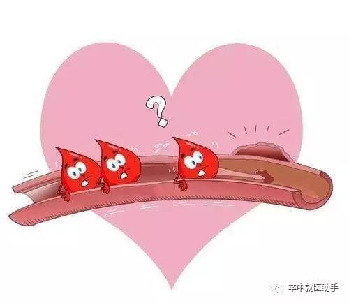 a型主动脉夹层是什么原因引起的,主动脉夹层b型支架对寿命的影响