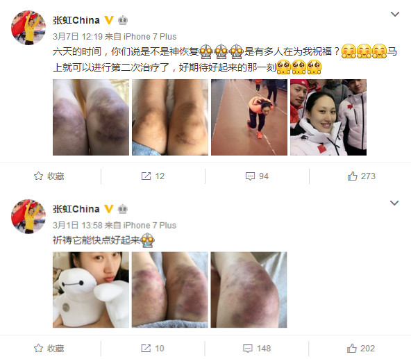 运动员的背后你知多少？训练练到双膝红肿淤青，甚至脚趾盖磨掉！