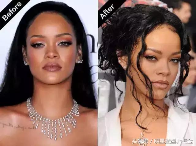 天生发量少怎么增多,天生发量少是缺什么