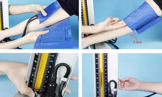 史上最全面的检查项目解读,为了你及家人的健康