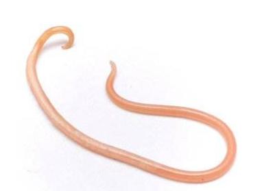 准妈妈实用技能:如何判断宝宝得了蛔虫病附治疗方式