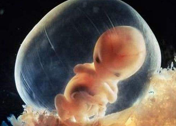 胎停育孕妇有哪些症状,胎停育孕妇会有哪些明显症状