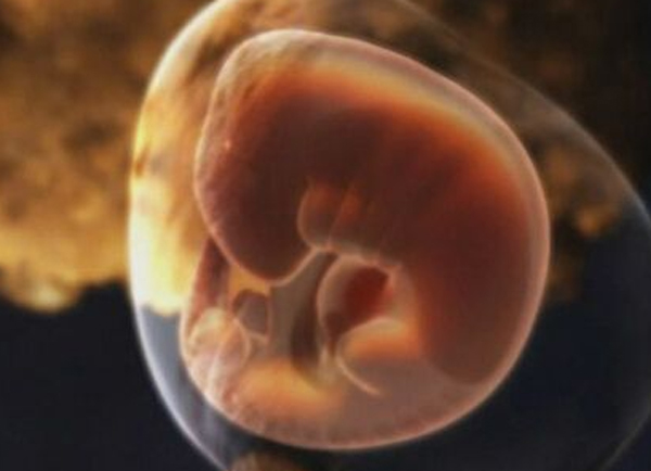 胎停育孕妇有哪些症状,胎停育孕妇会有哪些明显症状