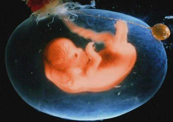 胎停育孕妇有哪些症状,胎停育孕妇会有哪些明显症状