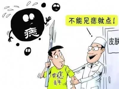 身上的痣去掉对今后有改观吗,身上有痣经常搓澡有癌变的可能吗