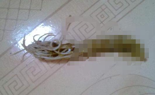 准妈妈实用技能:如何判断宝宝得了蛔虫病附治疗方式